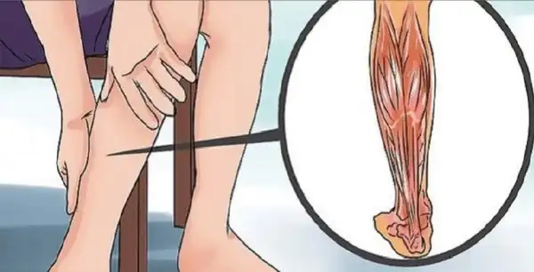 Chấn thương cơ bắp chân – Khi một cơn “chuột rút” là dấu hiệu của rách cơ tiềm ẩn